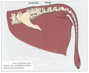 Figure 48 : Lieu d’injection pour réaliser les anesthésies épidurales sacrococcygiennes – Référence bibliographique n°14, page 70
