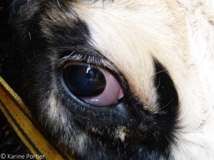 oedeme sclere rétrobulb