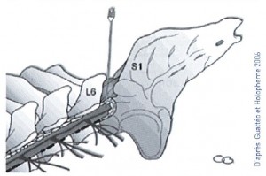 rachis - gtv 44 mai 2008