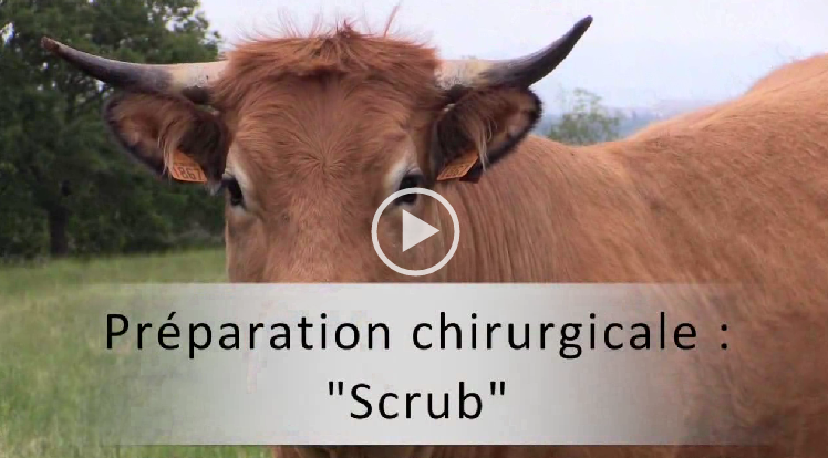 vidéo préparation chirurgicale : scrub vignette scrub